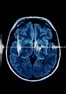 Энцефалограмма