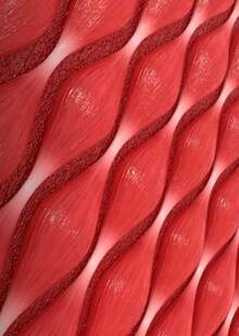 3D Medical Animation