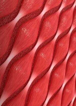3D Medical Animation