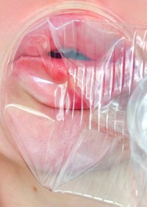 Деформация губ пластиковым стаканчиком