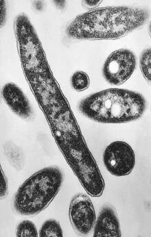 Вирусы, эпидемии, зомби