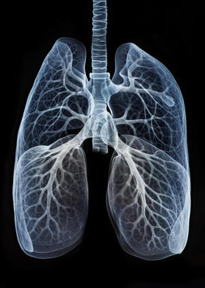 Туберкулёз