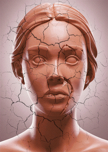 Fragility