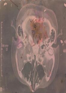 Brainturfly