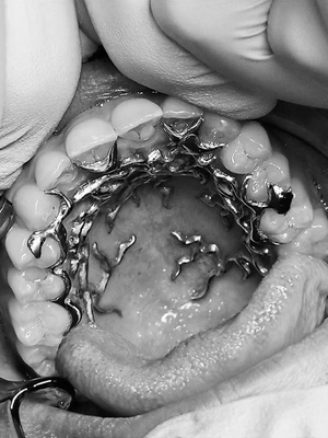 Зубы как медиум самовыражения в искусстве XXI века