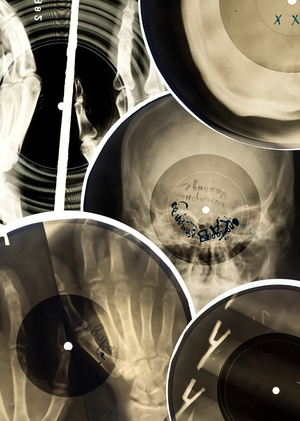 РЕНТГЕНОВСКОЕ ИСКУССТВО|X-RAY ART.