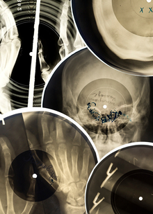 РЕНТГЕНОВСКОЕ ИСКУССТВО|X-RAY ART. РЕНТГЕНОВСКОЕ ИСКУССТВО|X-RAY ART.