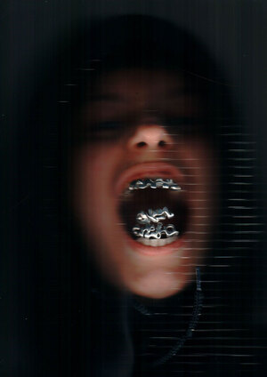 от зубов отскакивает