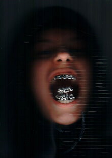 от зубов отскакивает