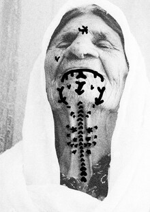 Модификация кожных покровов