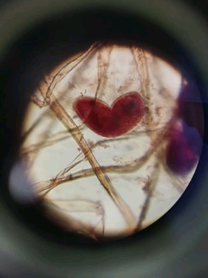 Сердце под микроскопом 