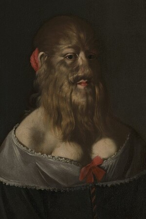 Изображение телесных аномалий в искусстве Западной Европы