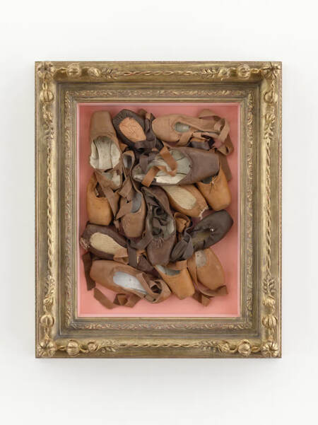 Травматичное тело за идеальной формой