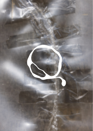 Osmotic font