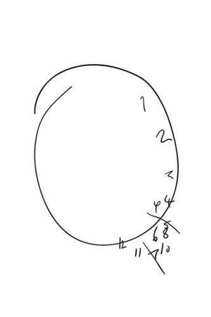 DEMENTION