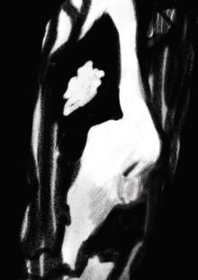 BlackMetal