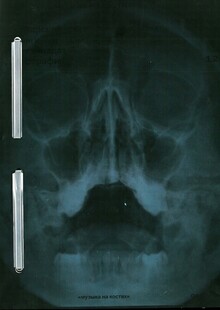 Catalogue of the "Music on Bones" exhibit
