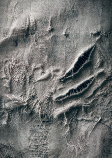 10. Растяжки, морщины и&nbsp;шрамы