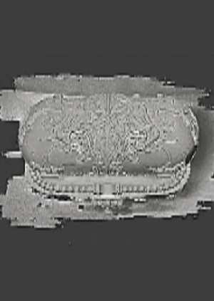 case dentate