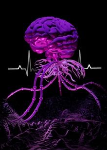 Neurologue Neurologue