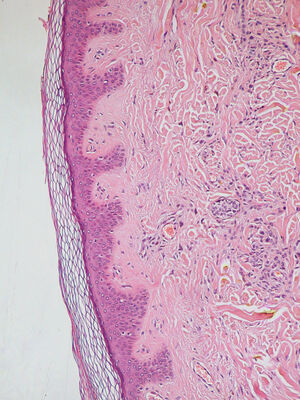 МИКРОХОРЕОГРАФИИ: ТЕОРИЯ И ПРАКТИКА ПРОВЕДЕНИЯ ТЕЛЕСНЫХ ГРАНИЦ