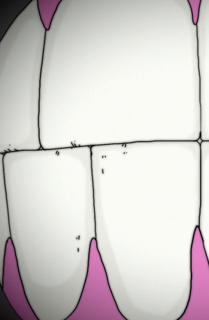 недоношенность