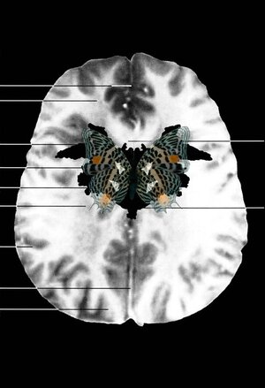 Тушки науки, или способы говорить о теле в Art&Science 
