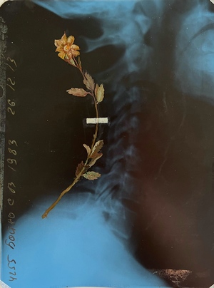 «Хрупкость»