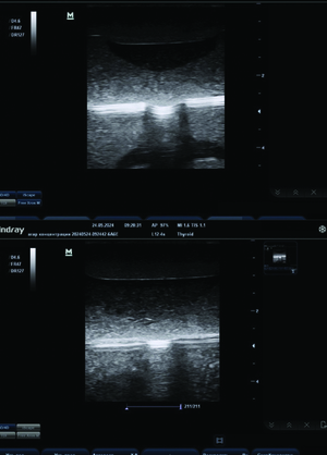 Сравнительный анализ эффективности 3д печати в медицине
