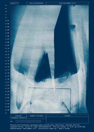 X-ray